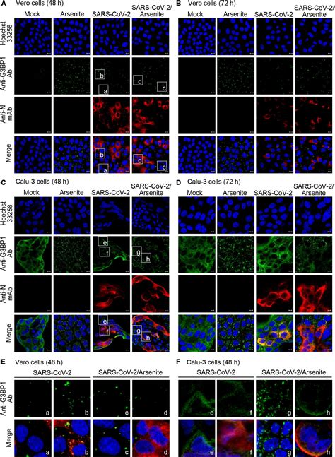 Frontiers Differential Effect Of Sars Cov Infection On Stress