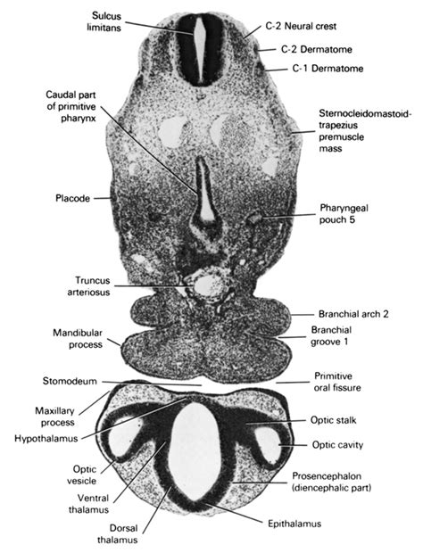 Atlas Of Human Embryos Figure 5 12 13