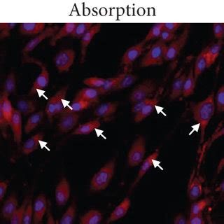 Exosomal CircEhmt1 Released From Hypoxia Stimulated Pericytes Protected