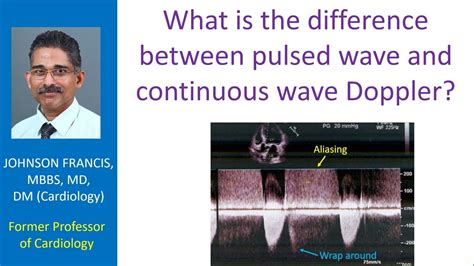 What Is The Difference Between Pulsed Wave And Continuous Wave Doppler