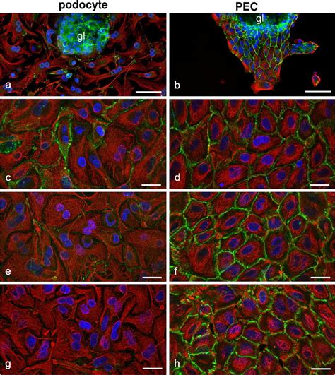 Double label immunofluorescence microscopic images showing α catenin