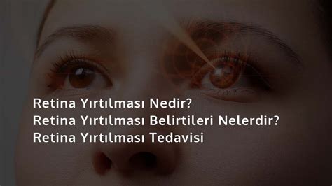 Retina Yırtılması Nedir Retina Yırtılmasının Belirtileri Nelerdir