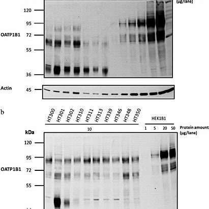 Western Blot Analysis Of Oatp B And Oatp B Glycosylation Total