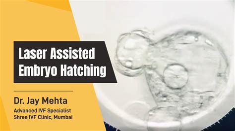 Laser Assisted Embryo Hatching Time Lapse Of Laser Assisted Hatching Dr Jay Mehta Shree