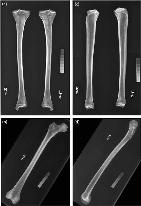 Example femur and tibiae radiographs. (a) (b) AP view, (c) (d) ML view ...