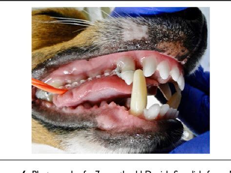 Figure 2 From Assessment Of Temporary Crown Extensions To Correct