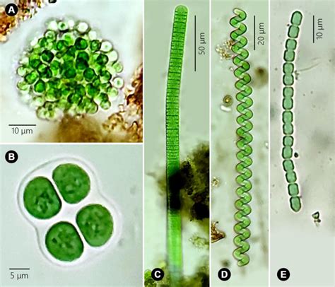 Cyanobacterial Species Found In This Study A Microcystis Sp B