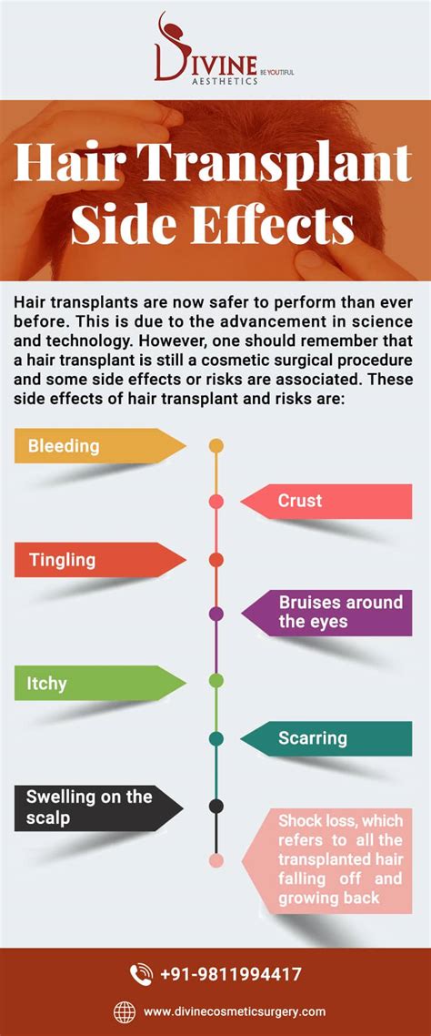 What Are The Side Effects Of Hair Transplant Surgery