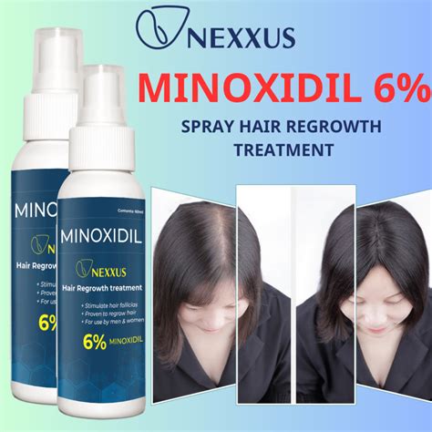 Nexxus Minoxidil Spray Hair Regrowth Treatment Topical Solution For