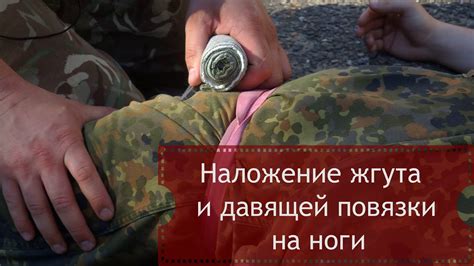 Наложение жгута и давящей повязки на ноги - YouTube
