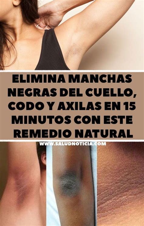 Elimina Manchas Negras Del Cuello Codo Y Axilas En 15 Minutos Con Este