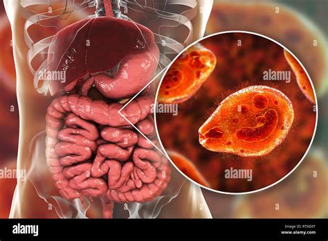 Balantidiasis Conceptual Image Computer Illustration Showing Close Up