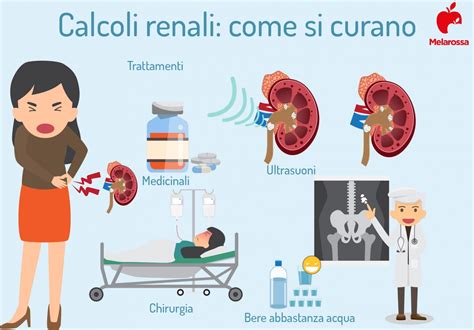 Calcoli Renali Cosa Sono Sintomi Cause Diagnosi Cura E Prevenzione