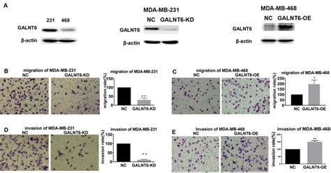 Effect Of Galnt6 On Mda Mb 231 And Mda Mb 468 Cell Migration And