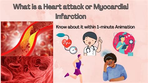 What Is Heart Attack Or Myocardial Infarction Know About It In 1