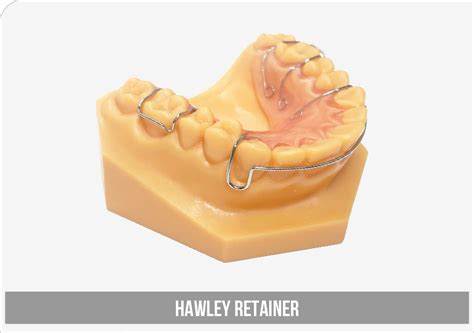 Hawley Retainer Solutions Dental Lab