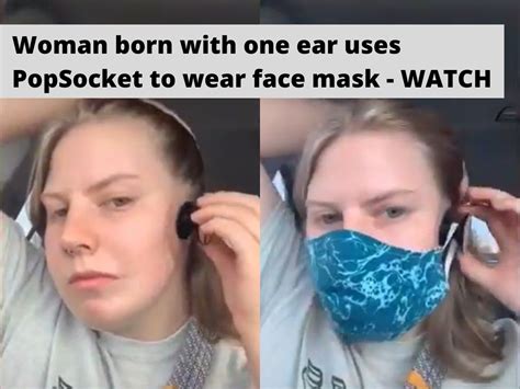 Woman With One Ear Uses Popsocket To Wear Face Mask Woman Born With