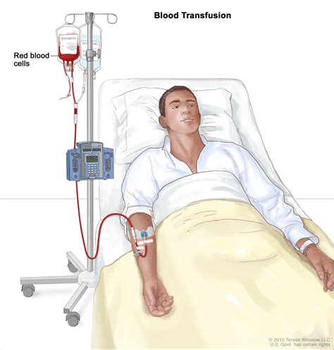 Definition Of Blood Transfusion Nci Dictionary Of Cancer Terms Nci