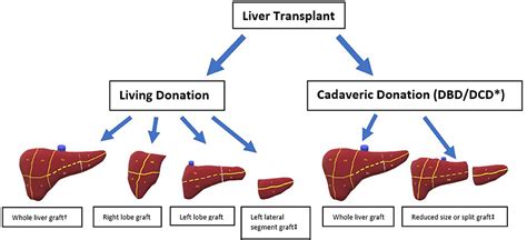 Frontiers The Human Immune Response To Cadaveric And Living Donor