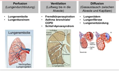 Vl Erkrankungen Des Atmungssystem Karteikarten Quizlet