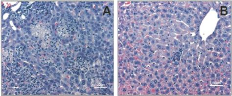 Liver Sections From Balbc Mice At 72 H After Infection With E