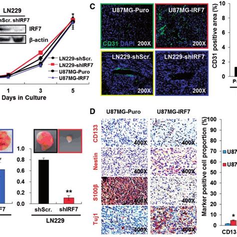 IRF7 induces tumorigenicity with increased angiogenesis and cell ... 