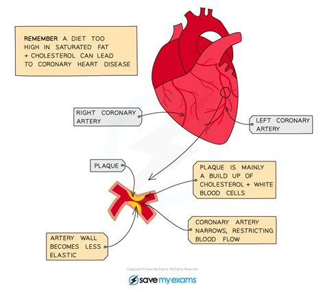 Cardiovascular Disease Edexcel Gcse Biology Revision Notes