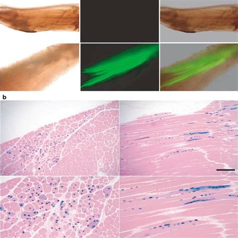 Transduction Of Mdx Skeletal Muscle Cells With Minidystrophin