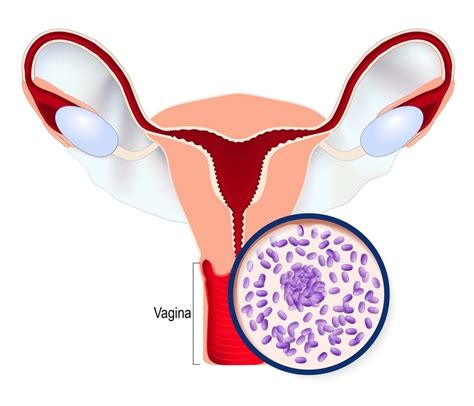 Bacterial Vaginosis Vs Yeast Infection Whats The Difference Flower Power® Feminine Health