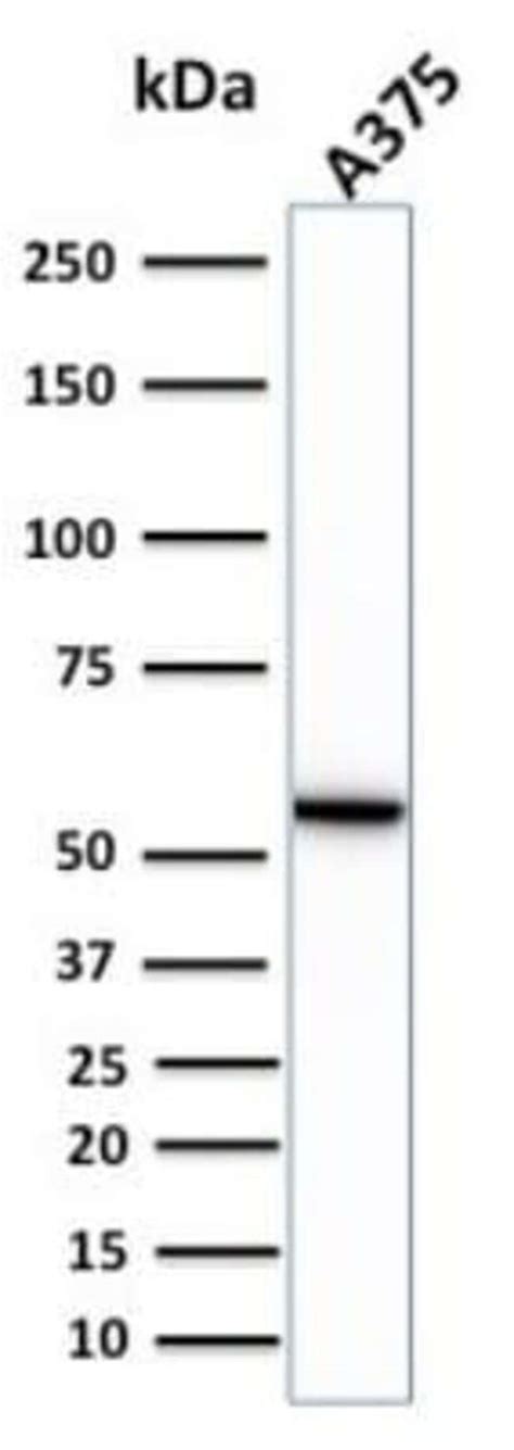 Vimentin Antibody Vim R Azide And Bsa Free Novus Biologicals