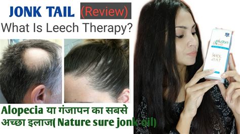 Jonk Tail Reviewwhat Is Leech Therapy For Alopecia Prevents Hair Loss