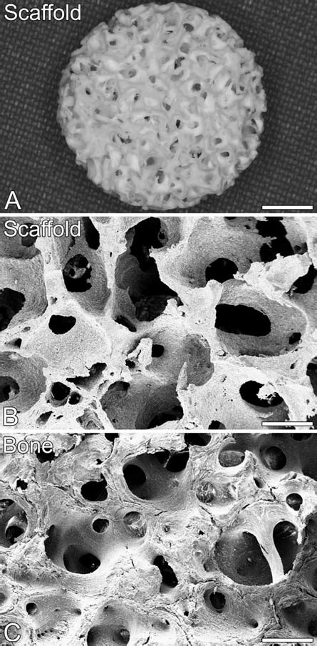 Architecture Of The Macroporous Biodegradable Scaffold Prepared By Download Scientific Diagram