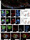 Jci Insight Icam Neutrophils Promote Chronic Inflammation Via