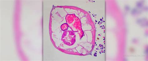 About appendix function | General center | SteadyHealth.com