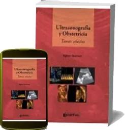 Ultrasonografia Y Obstetricia Temas Selectos PDF Gratis Mega