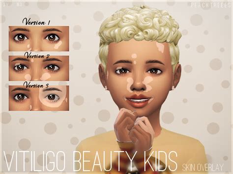 The Sims Resource - Vitiligo Beauty Skin Overlay KIDS N3