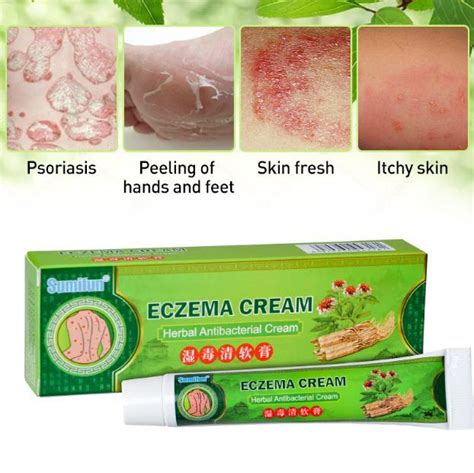 👍 100 Original And Effective Eczema Treatment Herbal Antibacterial Cream