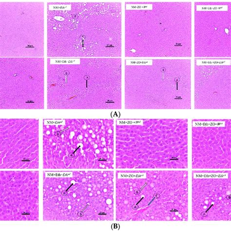 Photomicrographs Of Male A Liver Sections Stained With H E