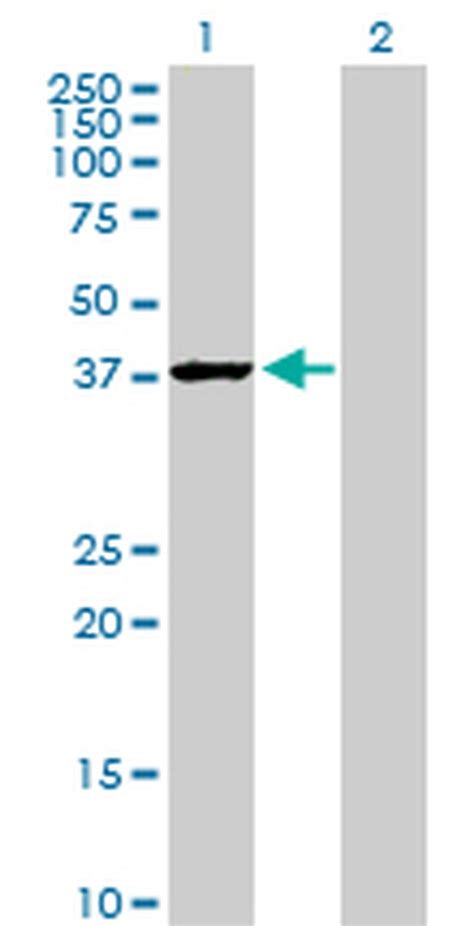 Gapdh Antibody H D P