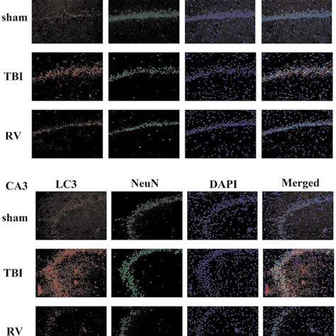 Co Localization Of Microtubule Associated Protein Light Chain Lc