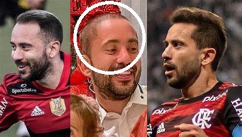 Ex calvo Jogador do Flamengo Everton Ribeiro chama atenção cabelos