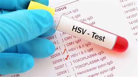 hsv    differentiating   herpes types