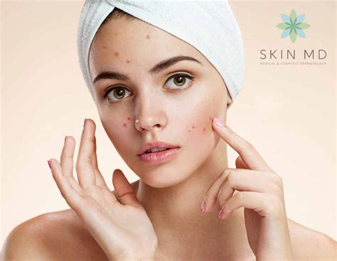 Post Facial Care To Get The Most Out Of Your Facial Treatment — Skin Md