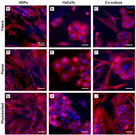 Cytoskeletal Staining Of Hdfs And Hacats On Different Fibrinogen