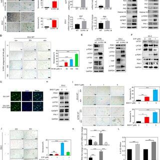 S Pr Regulates Ovarian Cancer Cell Senescence Through The