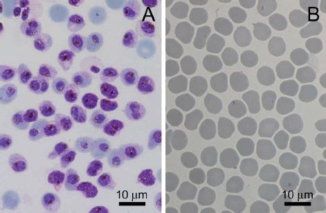 Light microscope images of Giemsa-stained red blood cell samples. (A ...