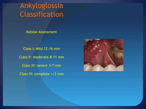 Ppt Ankyloglossia Powerpoint Presentation Free Download Id 2078965