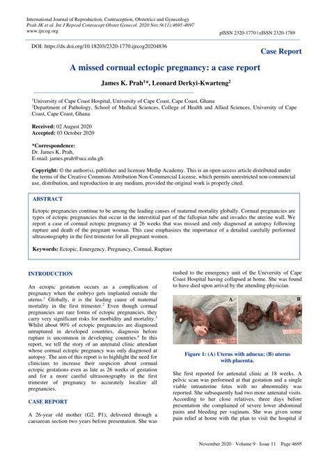 (PDF) A missed cornual ectopic pregnancy: a case report