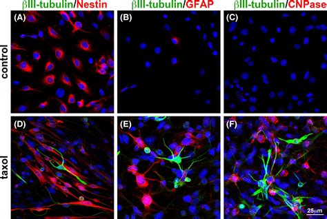 Induction Of Neural Differentiation In Rat C6 Glioma Cells With Taxol