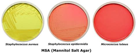 Mannitol Salt Agar Microbiolog A Apuntes De Clase Ciencia